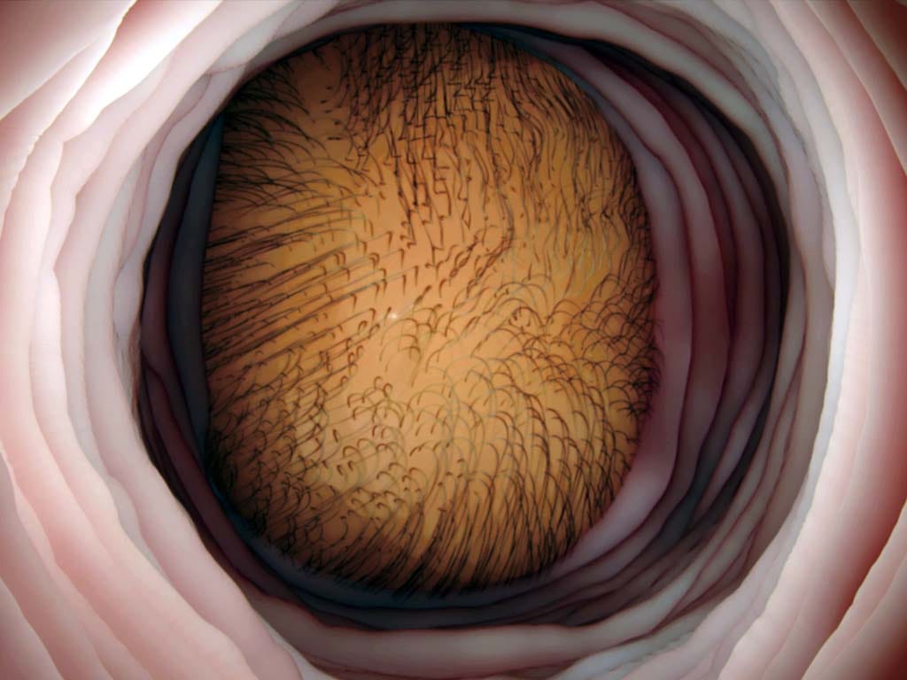 How can aging affect Vagina?